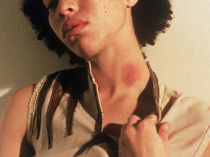 Hickey
