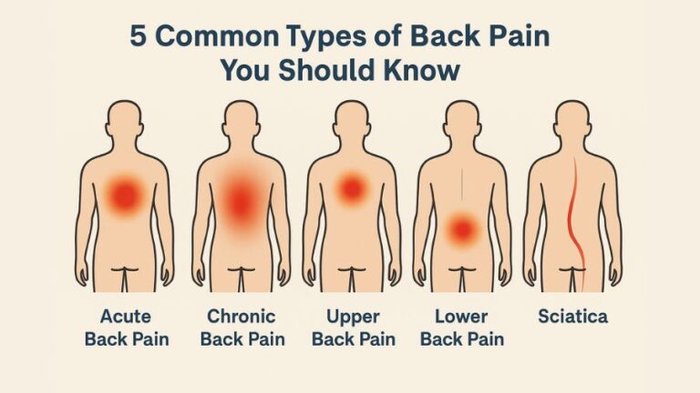 back pain