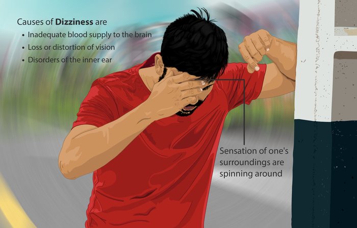 dizziness