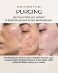 purging