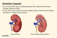 Uremia