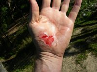 wound