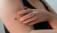 mole